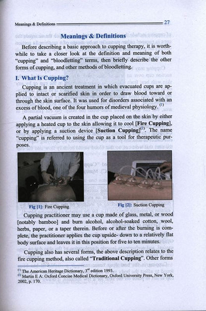 الحجامة: استكشاف _العلاج المفقود العظيم_الشفاء النبوي