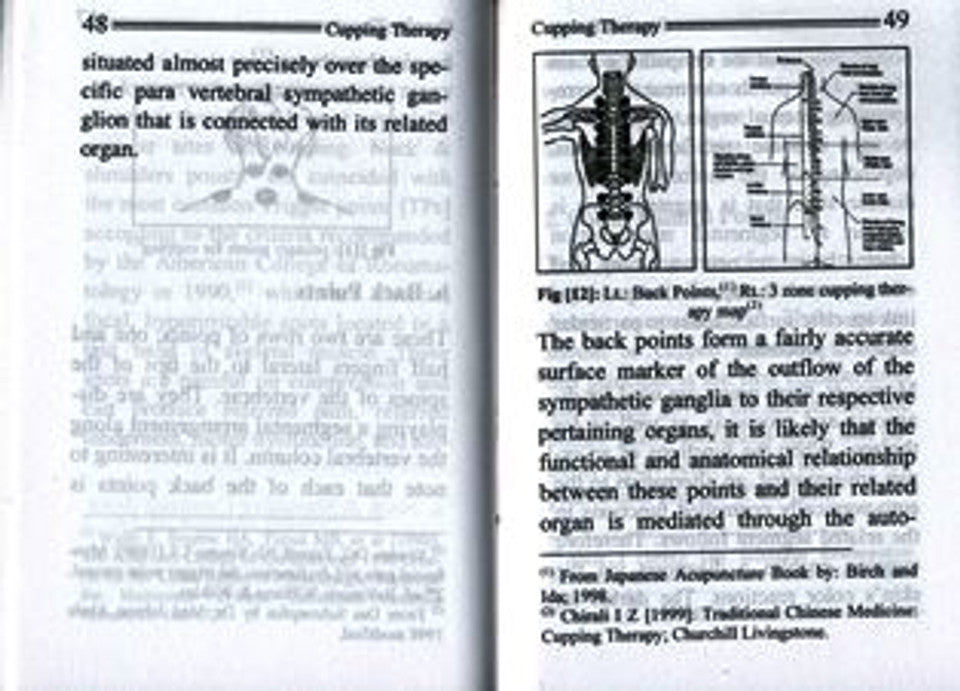 الحجامة_السنة النبوية_الطب النبوي (حجم الجيب)