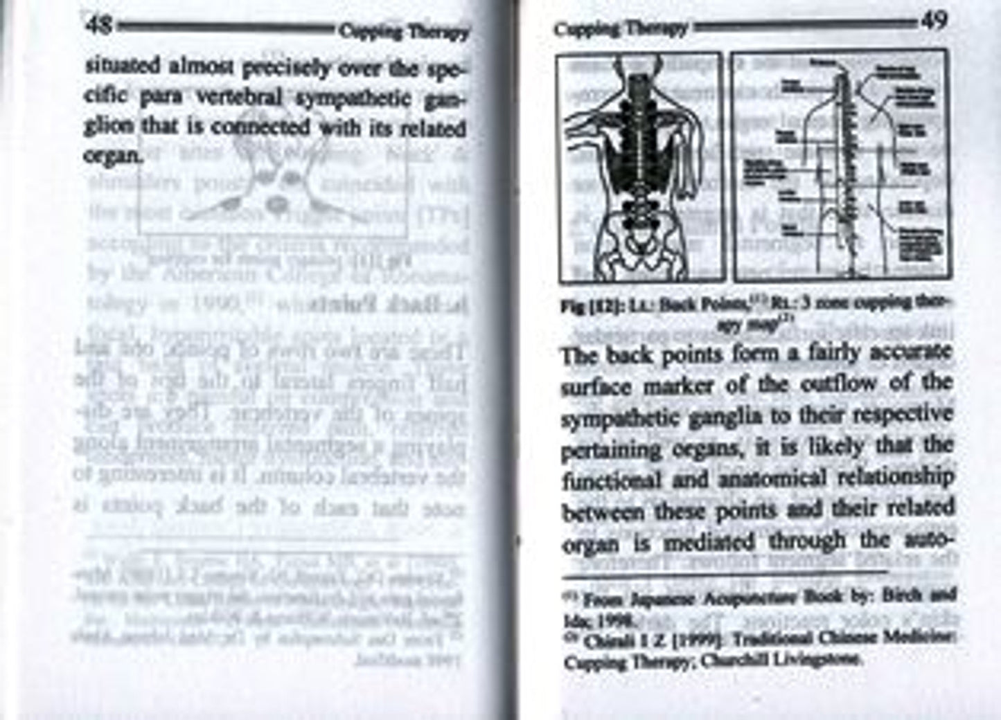 Cupping Therapy – The Ancient Art of Healing (Pocket Size) | Natural Pain Relief &amp; Detox Guide