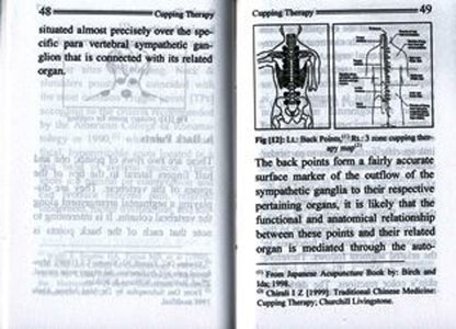 Cupping Therapy – The Ancient Art of Healing (Pocket Size) | Natural Pain Relief &amp; Detox Guide