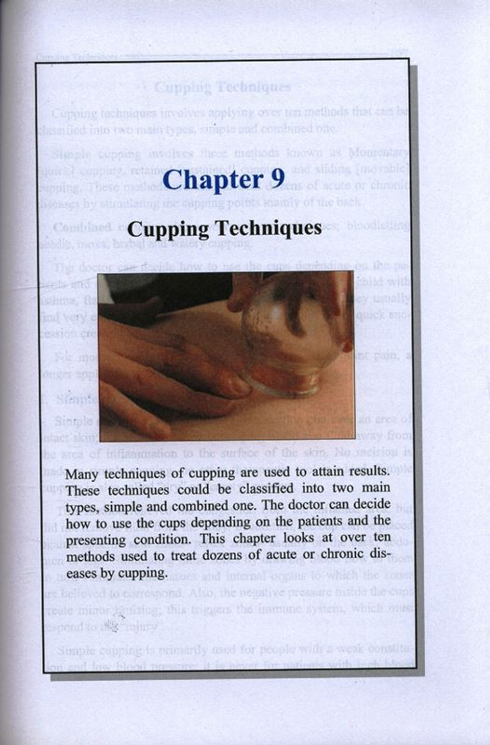 الحجامة: استكشاف _العلاج المفقود العظيم_الشفاء النبوي