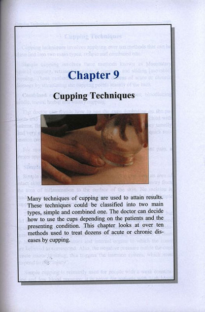 الحجامة: استكشاف _العلاج المفقود العظيم_الشفاء النبوي